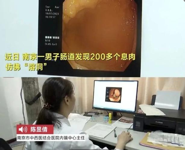 260斤男子担心患上胃癌，无痛胃肠镜检查为他排除隐患