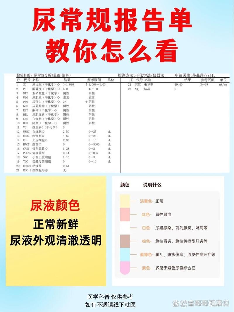 事关血液、尿液中酒精含量检验，推荐性国标3月实施