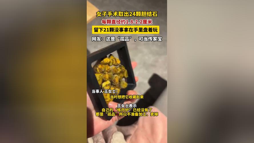 7岁小女孩体内竟取出近百颗碎结石 整个手术花费一个半小时